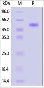 Human Siglec-3 / CD33 (140-232) Protein, Llama IgG2b Fc Tag, low endotoxin (MALS verified)