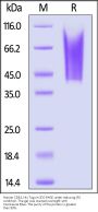 Human CD43 / leukosialin Protein, His Tag (MALS & SPR verified)