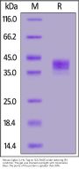 Mouse Siglec-3 / CD33 Protein, His Tag (MALS verified)