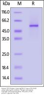 Human CD74 / DHLAG Protein, Llama IgG2b Fc Tag, low endotoxin