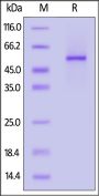 Human CD74 / DHLAG Protein, Llama IgG2b Fc Tag, low endotoxin