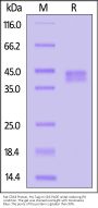 Rat Fc gamma RI / CD64 Protein, His Tag (MALS verified)