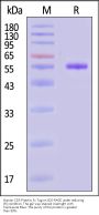 Human CD5 Protein, Fc Tag (MALS verified)