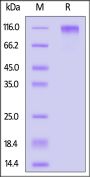 Human CD45RA / PTPRC protein, His Tag