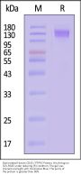 Biotinylated Human CD45 / PTPRC Protein, His,Avitag™
