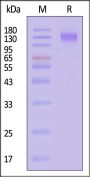 Biotinylated Human CD45 / PTPRC Protein, His,Avitag™