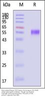 Biotinylated Mouse CD5 Protein, His,Avitag™ (MALS verified)