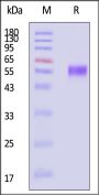 Biotinylated Mouse CD5 Protein, His,Avitag™ (MALS verified)