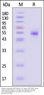 Rhesus macaque CD5 Protein, His Tag (MALS verified)