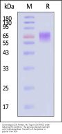 Cynomolgus CD6 Protein, His Tag (MALS verified)