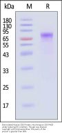 Biotinylated Human CD6 Protein, His,Avitag™ (MALS verified)