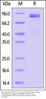 Mouse CD36 / SR-B3 Protein, Fc Tag