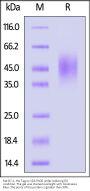 Rat B7-2 / CD86 Protein, His Tag