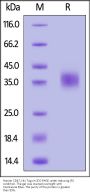 Human CD47 Protein, His Tag (MALS verified)