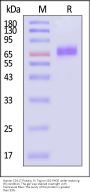 Human CD117 / c-kit Protein, Fc Tag (MALS verified)