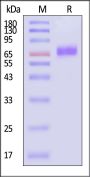 Human CD117 / c-kit Protein, Fc Tag (MALS verified)