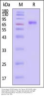 Cynomolgus CD39 Protein, His Tag (active enzyme, MALS verified)