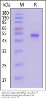 Human CD99 / MIC2 Protein, Llama IgG2b Fc Tag, low Endotoxin (MALS verified)
