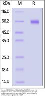 Human CD39 / ENTPD1 (Q96A, N99A, E143A, R147E) Protein, His Tag (active enzyme, MALS verified)