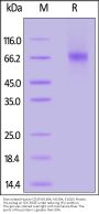 Biotinylated Human CD39 (R138A, M139A, E142K) Protein, His,Avitag™ (active enzyme)