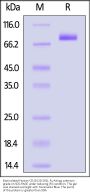 Biotinylated Human CD19 (20-291) Protein, Fc,Avitag™, premium grade