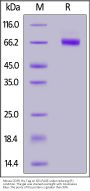 Mouse CD39 / ENTPD2 Protein, His Tag (active enzyme, MALS verified)