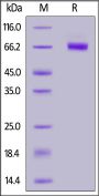 Mouse CD39 / ENTPD2 Protein, His Tag (active enzyme, MALS verified)