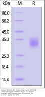 Human Fc gamma RIIA / CD32a (R167) Protein, Strep Tag (MALS & SPR verified)