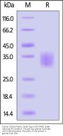 Human Fc gamma RIIA / CD32a (H167) Protein, Streptavidin Tag (MALS & SPR verified)