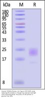 Human CD300a / LMIR1 Protein, His Tag (MALS verified)
