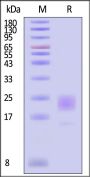 Human CD300a / LMIR1 Protein, His Tag (MALS verified)