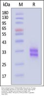 Biotinylated Human CD8 alpha&beta (CD8A&CD8B) Heterodimer Protein, His,Avitag™&Tag Free (MALS verified)