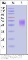 Human Fc gamma RIIIB / CD16b (NA2) Protein, Streptavidin Tag (MALS & SPR verified)