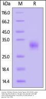 Human Fc gamma RIIB/C (CD32b/c) Protein, Streptavidin Tag (MALS & SPR verified)