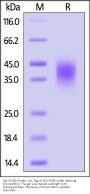 Rat Fc gamma RIIB / CD32b Protein, His Tag (MALS verified)