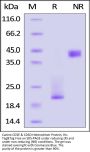 Canine CD3 epsilon & CD3 delta Heterodimer Protein, His Tag&Tag Free (MALS verified)