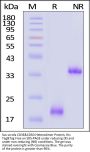 Sus scrofa CD3 epsilon&CD3 delta Heterodimer Protein, His Tag&Tag Free (MALS verified)