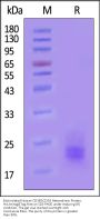 Biotinylated Human CD3 epsilon&CD3 gamma Heterodimer Protein, His,Avitag™&Tag Free (MALS verified)