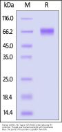 Human LILRB1 / CD85j / ILT2 Protein, His Tag (MALS verified)