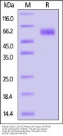 Human LILRB1 / CD85j / ILT2 (23-431) Protein, His Tag (MALS verified)