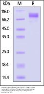 Human CD45RO Protein, His Tag (MALS verified)