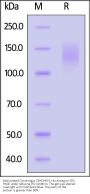 Biotinylated Cynomolgus CEACAM-5 / CD66e Protein, His,Avitag™ (MALS verified)