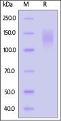 Biotinylated Cynomolgus CEACAM-5 / CD66e Protein, His,Avitag™ (MALS verified)