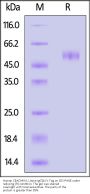 Human CEACAM-5 Protein, Llama IgG2b Fc Tag, low endotoxin (MALS verified)