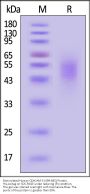 Biotinylated Human CEACAM-5 / CD66e (499-685) Protein, His,Avitag™ (MALS verified)