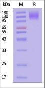 Rhesus macaque CEACAM-5 / CD66e Protein, His Tag (MALS verified)