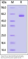 Human CLEC-2 / CLEC1B Protein, Fc Tag (MALS & SPR verified)