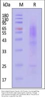 Biotinylated Human Claudin-18.2 Protein, His,Avitag™&Flag Tag (Detergent)