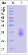Rat Clec4b2 Protein, His Tag