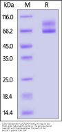 LCMV Glycoprotein C (R262A) Protein, His Tag